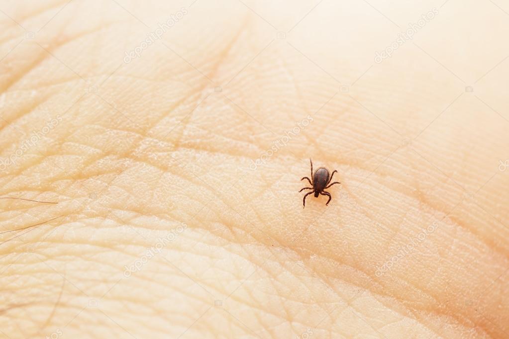 Tick on palm - tick identification