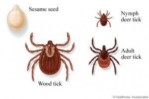 Chemicals aren’t the only way to control ticks.